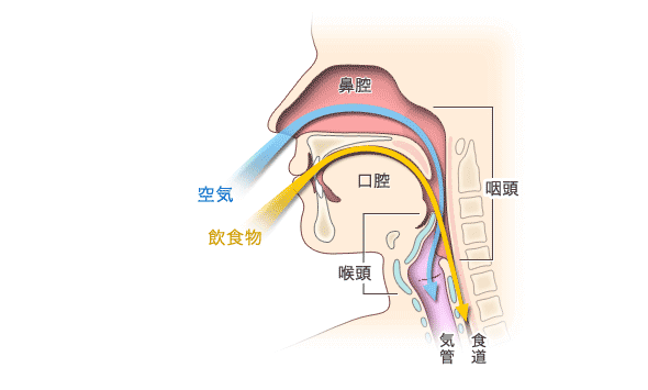 沈下性肺炎